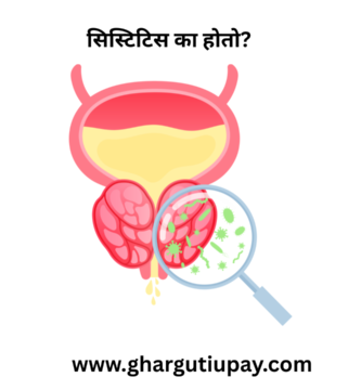 cystitis in marathi https://ghargutiupay.com/